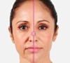 اقدامات تاثیرگزار برای مقابله با خطوط خنده