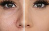شیوه های ساده کوچک کردن منافذ باز پوست
